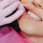 Cómo evitar la erosión dental