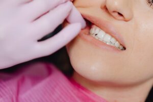 Cómo evitar la erosión dental