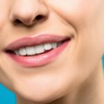 tratamientos dentales estéticos para mejorar tu sonrisa