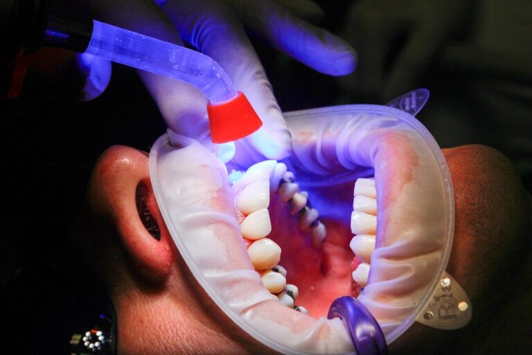 cirugia maxilofacial