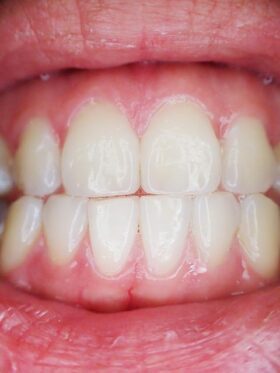 periodoncia en salamanaca