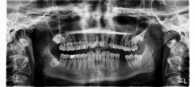 solucion para reponer piezas dentales