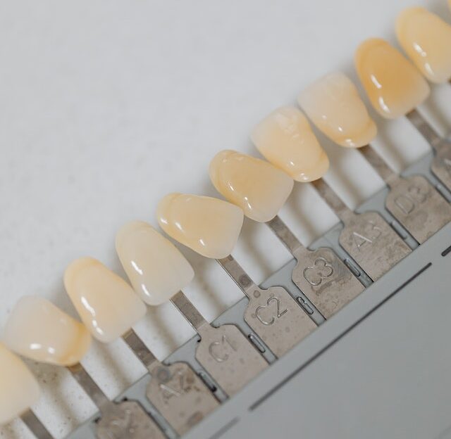 Dientes amarillos